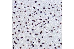 Immunohistochemistry of paraffin-embedded rat liver using BRMS1 Rabbit mAb (ABIN7265928) at dilution of 1:100 (40x lens). (BRMS1 anticorps)