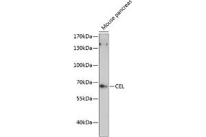 Western blot analysis of extracts of mouse pancreas, using CEL antibody (ABIN6132072, ABIN6138393, ABIN6138395 and ABIN6216837) at 1:3000 dilution. (Cholesterol Esterase anticorps  (AA 350-550))