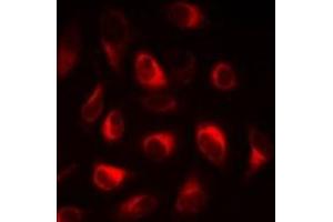 Immunofluorescent analysis of FABP5 staining in A549 cells. (FABP5 anticorps)