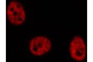 ABIN6274293 staining COLO205 cells by IF/ICC. (MLLT10 anticorps  (Internal Region))
