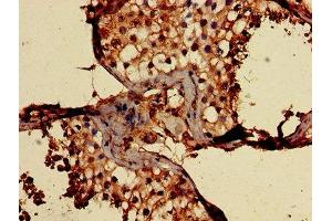 Immunohistochemistry of paraffin-embedded human testis tissue using ABIN7147167 at dilution of 1:100 (CD59 anticorps  (AA 26-102))