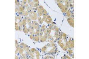 Immunohistochemistry of paraffin-embedded human stomach using SNAP29 antibody.