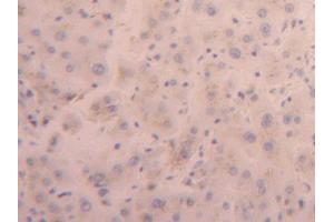 DAB staining on IHC-P; Samples: Human Liver Tissue