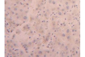 DAB staining on IHC-P; Samples: Human Liver Tissue (FURIN anticorps  (AA 105-221))