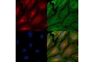 ABIN6259048 and ABIN6274810 staining  cells by IF/ICC. (ADAM32 anticorps  (C-Term))