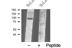 Western blot analysis of TM16J Antibody expression in Hela cells lysates. (ANO9 anticorps  (Internal Region))