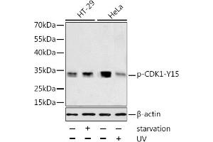 Western blot analysis of extracts of HT-29 and HeLa cells, using Phospho-CDK1-Y15 antibody (ABIN3019442, ABIN3019443, ABIN3019444 and ABIN6225371) at 1:1000 dilution. (CDK1 anticorps  (pTyr15))