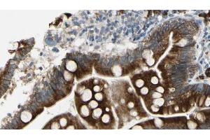 ABIN6267297 at 1/100 staining Mouse intestine tissue by IHC-P. (ATP1A1 anticorps  (pSer16))