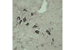 IHC on rat spinal cord using Rabbit antibody to internal part of Vacuolar protein sorting-associated protein 45 (rvps45, Vps45, Vps45a): IgG (ABIN351329) at a concentration of 10 µg/ml. (VPS45 anticorps)