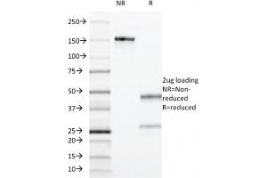 SDS-PAGE Analysis Purified CD55 Mouse Monoclonal Antibody (F4-29D9) .