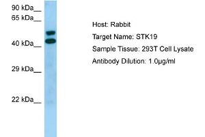 Western Blotting (WB) image for anti-serine/threonine Kinase 19 (STK19) (Middle Region) antibody (ABIN2774428) (STK19 anticorps  (Middle Region))