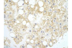 Rabbit Anti-NT5C antibody Catalog Number: ARP39112_P050  Paraffin Embedded Tissue: Human Placenta cell  Cellular Data: Epithelial cells of renal tubule Antibody Concentration:  4.