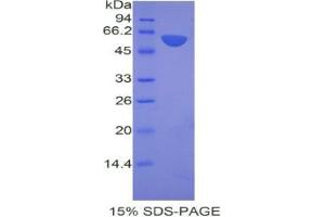 SDS-PAGE analysis of Mouse ANP32A Protein. (PHAP1 Protéine)