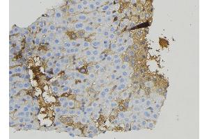ABIN6274923 at 1/100 staining Mouse liver tissue by IHC-P. (BRP44L anticorps  (Internal Region))