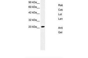 Image no. 2 for anti-MYST/Esa1-Associated Factor 6 (MEAF6) (N-Term) antibody (ABIN6736265) (MEAF6 anticorps  (N-Term))