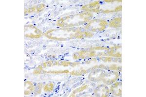 Immunohistochemistry of paraffin-embedded mouse kidney using FABP6 antibody at dilution of 1:200 (40x lens). (FABP6 anticorps)