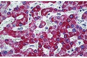 Human Liver: Formalin-Fixed, Paraffin-Embedded (FFPE)