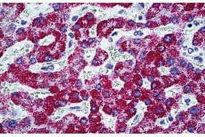 Human Liver: Formalin-Fixed, Paraffin-Embedded (FFPE) (CPS1 anticorps  (AA 1400-1501))