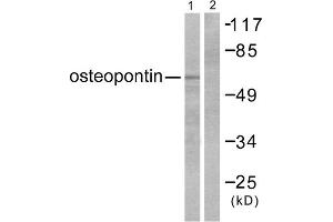 Western blot analysis of extracts from LOVO cells, using osteopontin antibody (ABIN5976474). (Osteopontin anticorps  (C-Term))