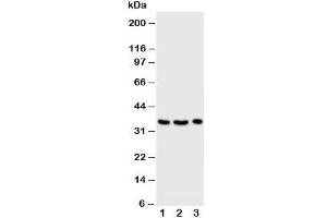 Western blot testing of Granzyme A antibody and Lane 1:  Jurkat;  2: CEM;  3: Raji cell lysate (GZMA anticorps  (Middle Region))