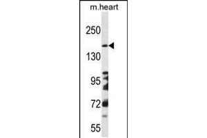 Western blot analysis in mouse heart tissue lysates (35ug/lane). (DCC anticorps  (AA 643-670))