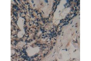 Used in DAB staining on fromalin fixed paraffin- embedded Kidney tissue (ADAMTS10 anticorps  (AA 239-602))