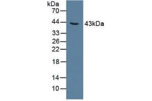 Figure. (AGXT anticorps  (AA 182-371))