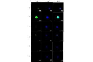 PLC-δ3 involvement in the pathway of NAD+-mediated stimulation of MUC2 expression.