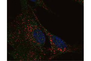 RA differentiated SH-SY5Y neuroblastoma cells were stained with Mouse Anti-Human CD107b-UNLB (LAMP2 anticorps)