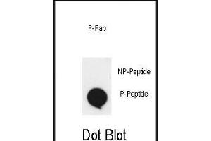 Dot blot analysis of anti-phospho-EphA2-p Phospho-specific Pab (ABIN650858 and ABIN2839809) on nitrocellulose membrane. (EPH Receptor A2 anticorps  (pSer897))