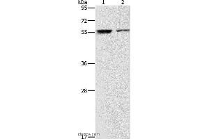 Western blot analysis of Jurkat and 293T cell, using ARHGAP15 Polyclonal Antibody at dilution of 1:500 (ARHGAP15 anticorps)