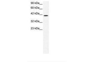 Image no. 2 for anti-CCR4 Carbon Catabolite Repression 4-Like (CCRN4L) (AA 82-131) antibody (ABIN202510) (CCRN4L anticorps  (AA 82-131))
