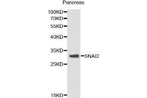 Western Blotting (WB) image for anti-Snail Family Zinc Finger 2 (SNAI2) (AA 89-268) antibody (ABIN6214866) (SLUG anticorps  (AA 89-268))