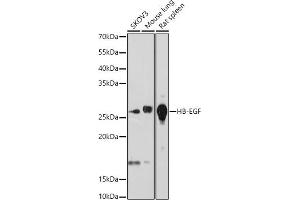 Western blot analysis of extracts of various cell lines, using HB-EGF antibody (ABIN7267616) at 1:1000 dilution. (HBEGF anticorps)