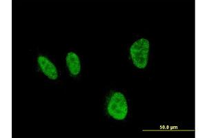 Immunofluorescence of monoclonal antibody to HOXA5 on HeLa cell. (HOXA5 anticorps  (AA 171-270))