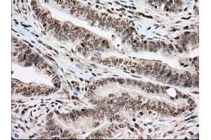 Immunohistochemical staining of paraffin-embedded Human pancreas tissue using anti-USP5 mouse monoclonal antibody. (USP5 anticorps)