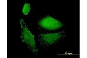 Image no. 3 for anti-Vesicle-Associated Membrane Protein 1 (Synaptobrevin 1) (VAMP1) (AA 28-97) antibody (ABIN598952) (VAMP1 anticorps  (AA 28-97))