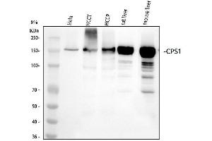 Western blot analysis of CPS1 using anti-CPS1 antibody (ABIN7604490).