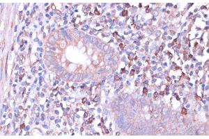Immunohistochemistry of paraffin-embedded Human appendix using PRKACB Polyclonal Antibody at dilution of 1:100 (40x lens).