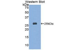 Western Blotting (WB) image for anti-Hexosaminidase A (HEXA) (AA 319-528) antibody (ABIN1859137)