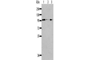 Gel: 8 % SDS-PAGE, Lysate: 40 μg, Lane 1-3: Jurkat cells, 293T cells, K562 cells, Primary antibody: ABIN7128323(AKAP8L Antibody) at dilution 1/117, Secondary antibody: Goat anti rabbit IgG at 1/8000 dilution, Exposure time: 30 seconds (AKAP8L anticorps)