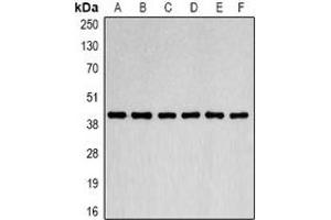 Western blot analysis of Beta-actin expression in Jurkat (A), MCF7 (B), NIH3T3 (C), mouse brain (D), rat brain (E), COS7 (F) whole cell lysates.