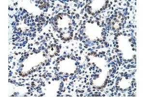 CARS antibody was used for immunohistochemistry at a concentration of 4-8 ug/ml to stain Alveolar cells (arrows) in Human Lung.