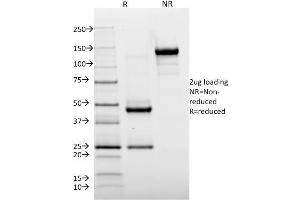 SDS-PAGE Analysis Purified HLA-DR Mouse Monoclonal Antibody (TAL 1B5). (HLA-DR anticorps)