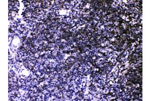 Anti- ATP2A3 antibody, IHC(P) IHC(P): Mouse Thymus Tissue