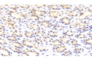 Detection of TNC in Rat Stomach Tissue using Polyclonal Antibody to Tenascin C (TNC)