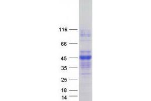 Validation with Western Blot