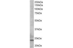 Image no. 1 for anti-BCL2-Like 11 (Apoptosis Facilitator) (BCL2L11) (C-Term) antibody (ABIN374444) (BIM anticorps  (C-Term))