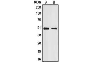 Western blot analysis of E2F2 expression in A431 (A), Jurkat (B) whole cell lysates.