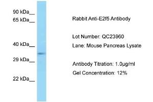 Host: Rabbit Target Name: E2f5 Sample Type: Mouse Pancreas Antibody Dilution: 1. (E2F5 anticorps  (C-Term))